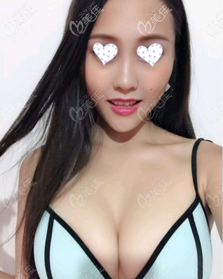 傲諾拉璀璨250cc290cc效果圖