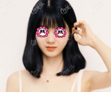 上下唇厚的我花了不到5000元做了厚唇改薄術(shù)，一個月后成功擁有迷人微笑唇！