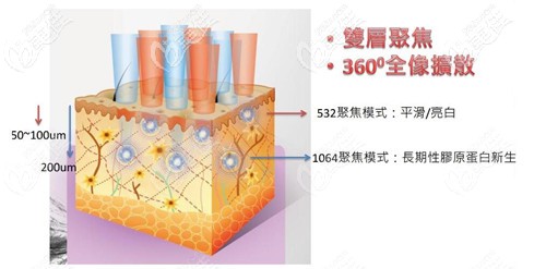 皮秒1064和532的光波區(qū)別 皮秒1064和532的光波區(qū)別