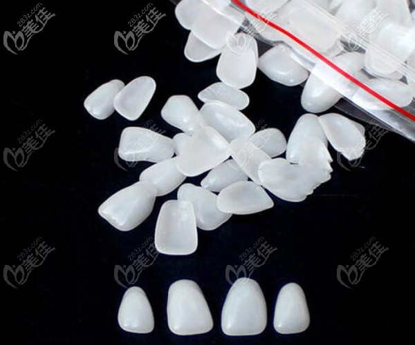 牙齒貼面材料類型 牙齒貼面材料類型