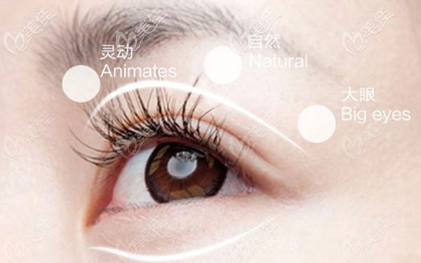 玉林華美哪個醫(yī)生做雙眼皮好