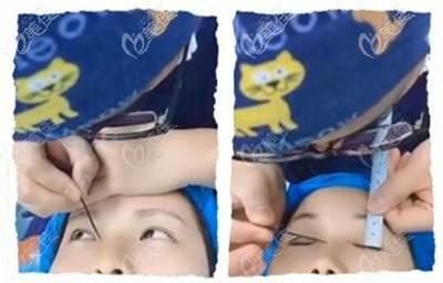 楊小順醫(yī)生方案設(shè)計 楊小順醫(yī)生方案設(shè)計