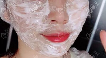 做fotona 4d提升面部可以不敷麻藥