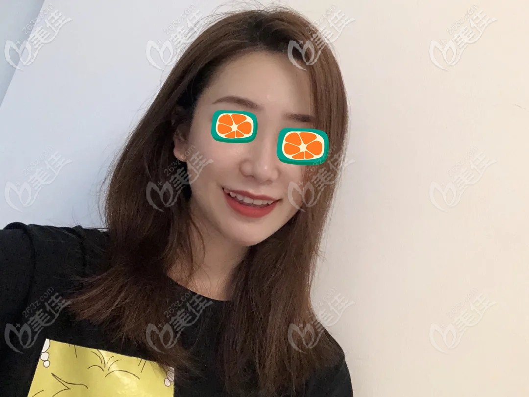 24歲輕度地包天戴隱適美牙套矯正效果還挺管用,沒想到地包天正畸后臉型還改變了點(diǎn)