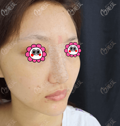 做完手術(shù)第6天 做完手術(shù)第6天