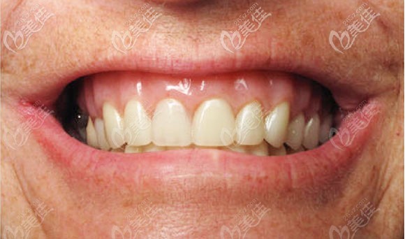 北京中諾口腔種植牙<span style= 北京中諾口腔種植牙<span style=