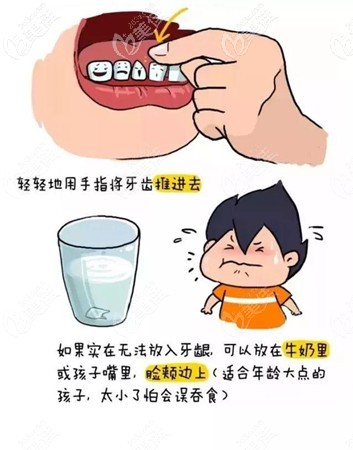 牙齒脫落后的保存辦法 牙齒脫落后的保存辦法