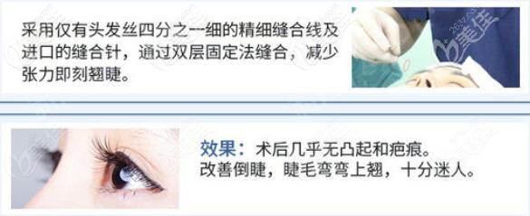 宜春華美割雙眼皮技術(shù)優(yōu)勢 宜春華美割雙眼皮技術(shù)優(yōu)勢