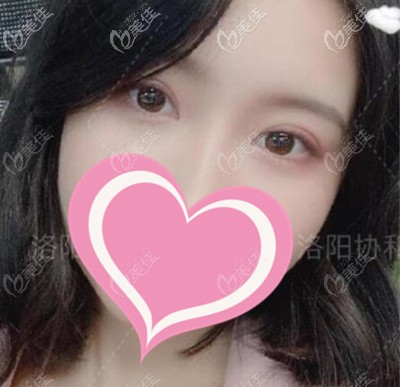 手術(shù)后恢復(fù)2個(gè)月