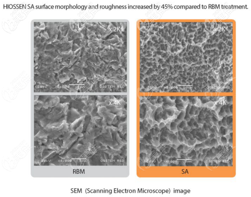 美國皓圣種植體類型 美國皓圣種植體類型