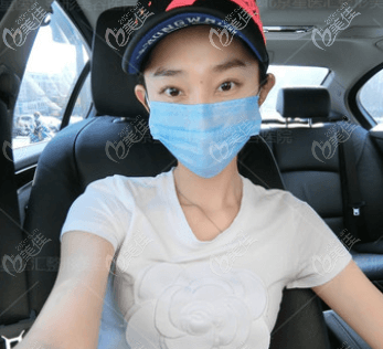 北京如朵醫(yī)療美容門診部季一發(fā)術(shù)前照片1