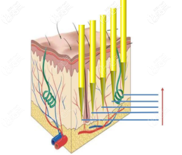 射頻緊膚動畫效果圖