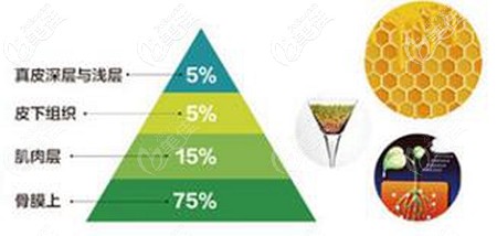 張讓虎做脂肪填充面部的優(yōu)勢 張讓虎做脂肪填充面部的優(yōu)勢