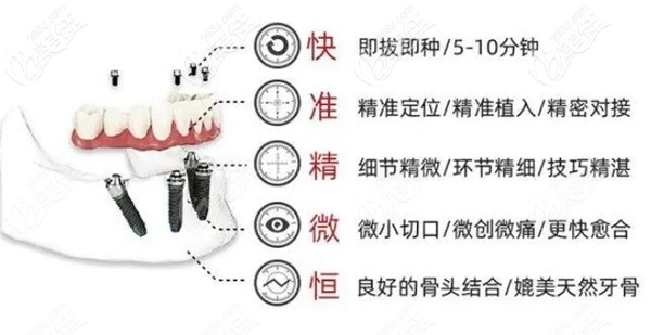 ALL-ON-4數(shù)字化即刻負重優(yōu)勢