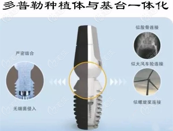 韓國duplo多普勒種植體 韓國duplo多普勒種植體