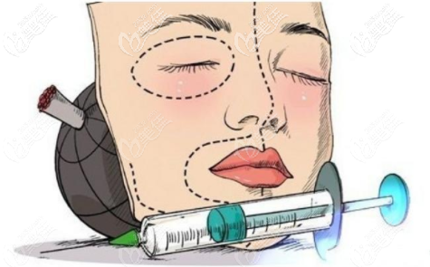 注射植骨隆鼻 注射植骨隆鼻