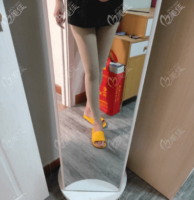 北京達(dá)美如藝大腿環(huán)吸半個(gè)多月了 北京達(dá)美如藝大腿環(huán)吸半個(gè)多月了