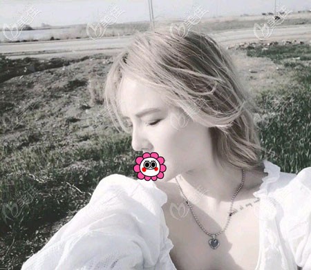 找寧波林勇做鼻子怎么樣呀？想了解更多看價格和案例圖