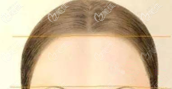 飽滿的額頭示意圖