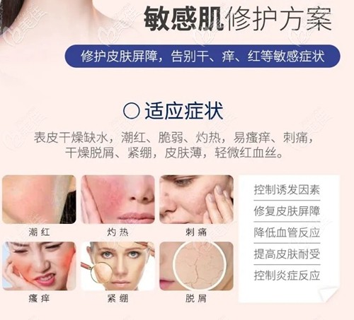雪夫美塑可以改善敏感肌 雪夫美塑可以改善敏感肌