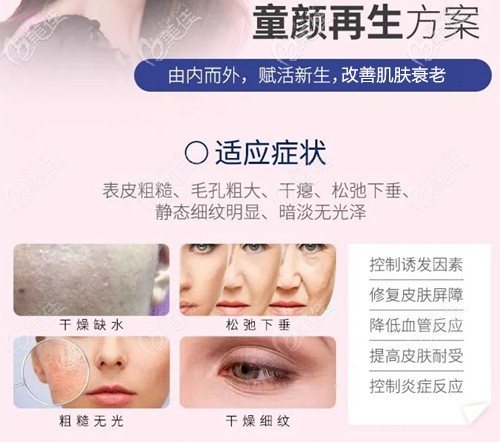 雪夫美塑可以改善細(xì)紋 雪夫美塑可以改善細(xì)紋