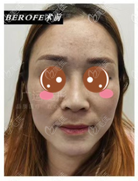 <!--<i data=20240703-sp></i>-->做拉皮怎么樣 <!--<i data=20240703-sp></i>-->做拉皮怎么樣