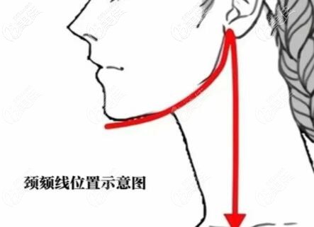 下頜緣位置示意圖