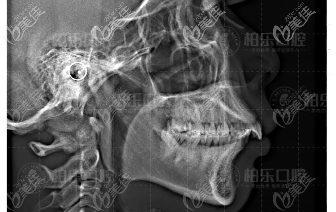 口腔ct 口腔ct