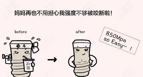 德國(guó)ICX種植體的使用壽命 德國(guó)ICX種植體的使用壽命