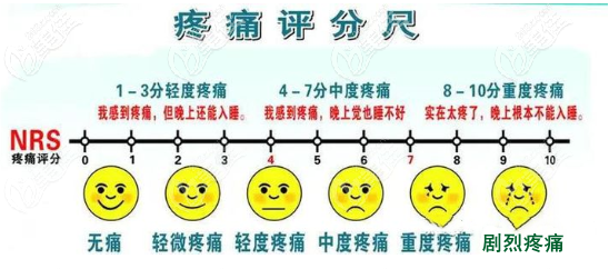 疼痛等級