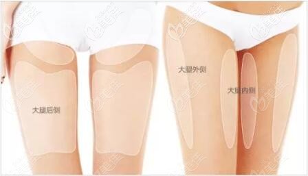 大腿環(huán)吸的位置
