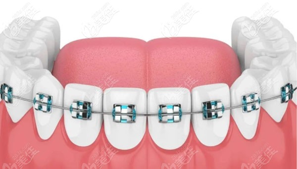 鄭州南區(qū)口腔醫(yī)院牙齒矯正醫(yī)生 鄭州南區(qū)口腔醫(yī)院牙齒矯正醫(yī)生