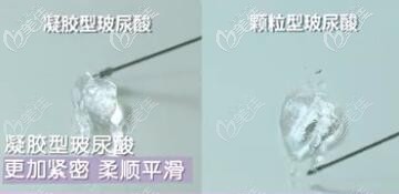 喬雅登豐顏玻尿酸的質(zhì)地類型