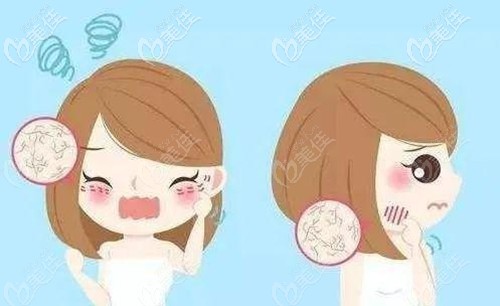 換季皮膚干燥缺水