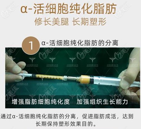 北京潤美玉之光O型腿脂肪填充 北京潤美玉之光O型腿脂肪填充