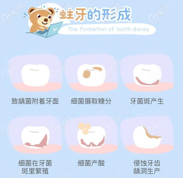 兒童蛀牙的危害 兒童蛀牙的危害