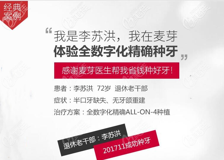 72歲老人在麥芽體驗(yàn)allon4下半口種植牙