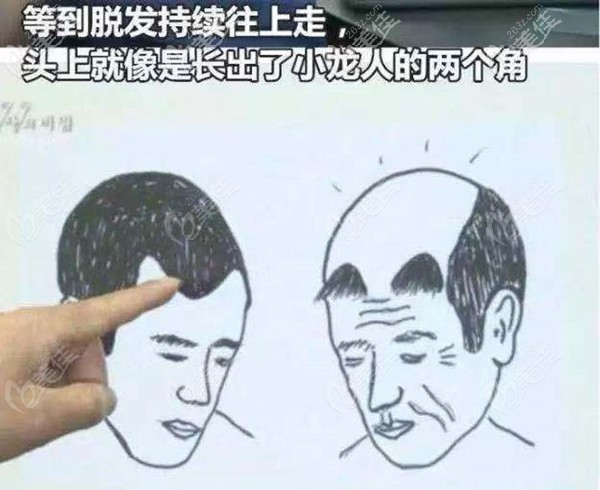 植發(fā)后用米諾和非那可能會出現(xiàn)的情況