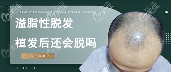 脂溢性脫發(fā)植發(fā)后還會出現(xiàn)掉發(fā)脫發(fā)情況嗎？