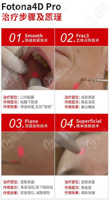 做歐洲之星不會被燙傷