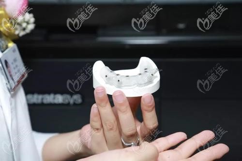 數(shù)字化導板種植牙 數(shù)字化導板種植牙