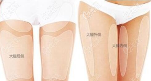 大腿抽脂2個(gè)月了還是又硬又癢怎么回事