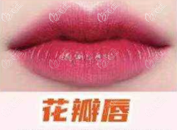 花瓣唇