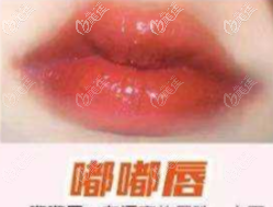 嘟嘟唇
