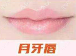 月牙唇