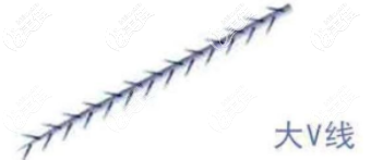 大V 線是什么材料做的
