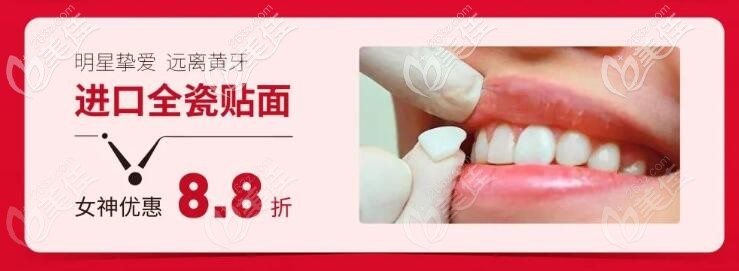 牙齒貼面活動價