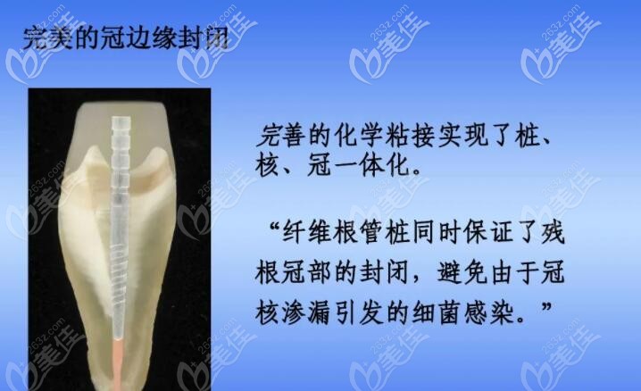 纖維樁封閉示意圖