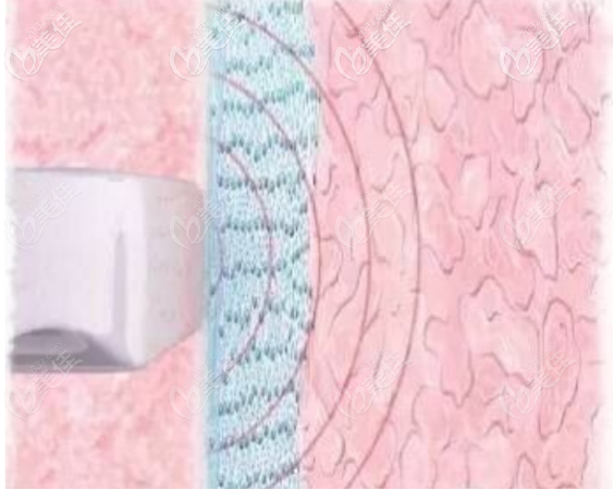 薇蜜作用在陰道的距離