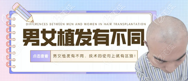 男女植發(fā)有著不同